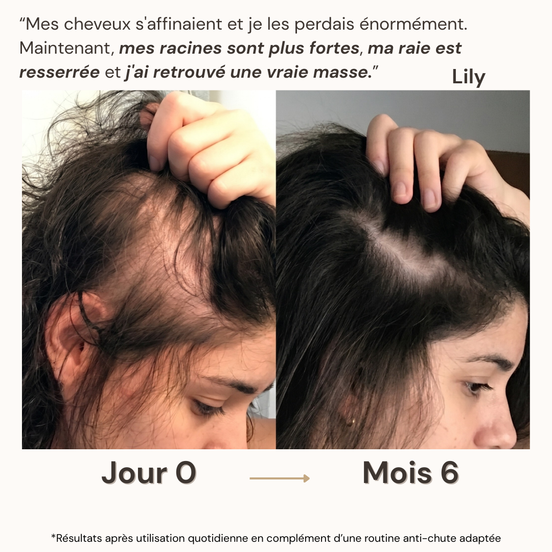 Pommeau de soin capillaire densifiant
