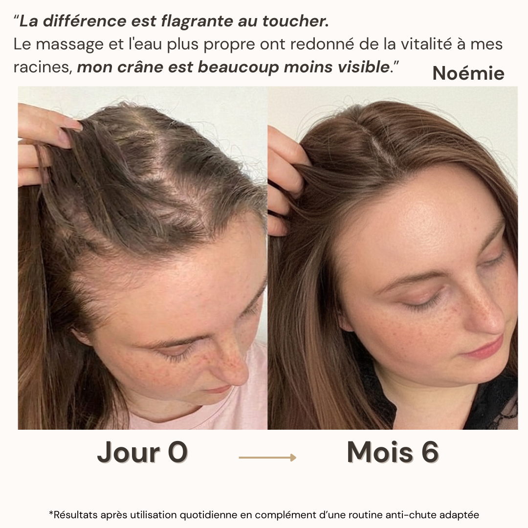 Pommeau de soin capillaire densifiant
